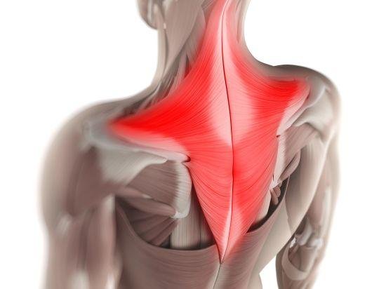 Trapezitis